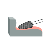 Борфреза параболическая F 14х25 M06 алмазная насечка RODMIX 2614250604